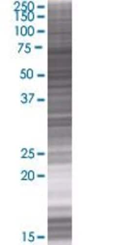Abnova KIAA1018 293T Cell Transient Overexpression Lysate (Denatured) (T01) 100 &mu;L | Buy Online | Abnova&trade; | Fisher Scientific