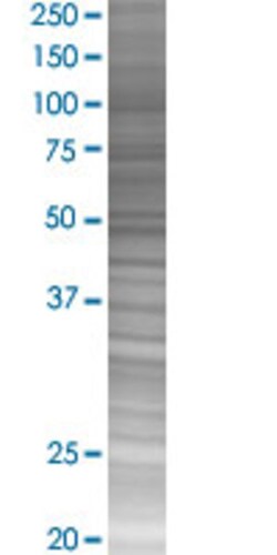 Abnova&trade;&nbsp;TNIK 293T Cell Transient Overexpression Lysate (Denatured)