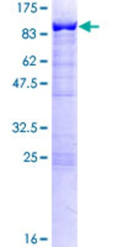 Abnova Human SWAP70 Full-length ORF (NP_055870.2, 1 a.a. - 585 a.a.) Recombinant Protein with GST-tag at N-terminal 25 &mu;g | Buy Online | Abnova&trade; | Fisher Scientific