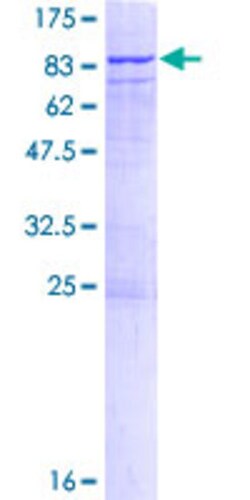 Abnova Human CDC2L6 Full-length ORF (NP_055891.1, 1 a.a. - 502 a.a.) Recombinant Protein with GST-tag at N-terminal 2&mu;g | Buy Online | Abnova&trade; | Fisher Scientific