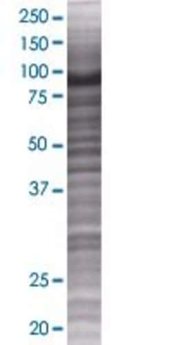 Abnova MAP3K7IP2 293T Cell Transient Overexpression Lysate (Denatured) 100 &mu;l | Buy Online | Abnova&trade; | Fisher Scientific
