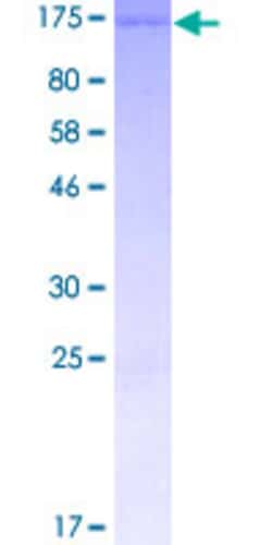 Abnova™ Human LPIN1 Full-length ORF (AAH30537, 1 a.a. - 890 a.a.) Recombinant Protein with GST-tag at N-terminal