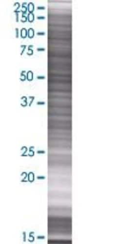 Abnova ACSBG1 293T Cell Transient Overexpression Lysate (Denatured) (T01) 100 &mu;L | Buy Online | Abnova&trade; | Fisher Scientific