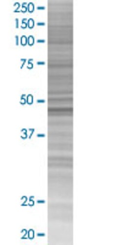 Abnova RRS1 293T Cell Transient Overexpression Lysate (Denatured) (T04) 100&mu;L | Buy Online | Abnova&trade; | Fisher Scientific