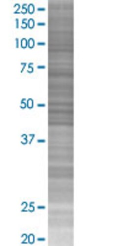 Abnova ASTN2 293T Cell Transient Overexpression Lysate (Denatured) (T02) 100 &mu;L | Buy Online | Abnova&trade; | Fisher Scientific