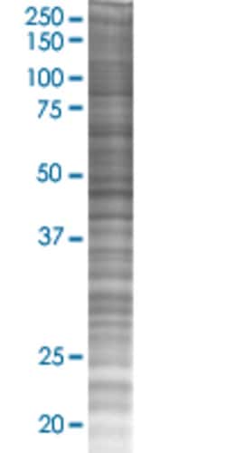 Abnova DNMBP 293T Cell Transient Overexpression Lysate (Denatured) 100 &mu;L | Buy Online | Abnova&trade; | Fisher Scientific