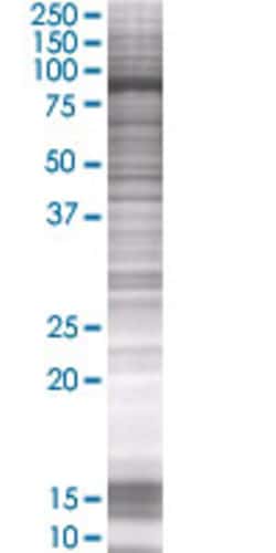Abnova VPS39 293T Cell Transient Overexpression Lysate (Denatured) 100 &mu;L | Buy Online | Abnova&trade; | Fisher Scientific