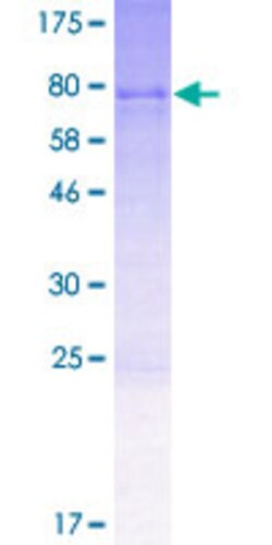 Abnova Human UFL1 Full-length ORF (AAH28608.1, 1 a.a. - 509 a.a.) Recombinant Protein with GST-tag at N-terminal 2 &mu;g | Buy Online | Abnova&trade; | Fisher Scientific