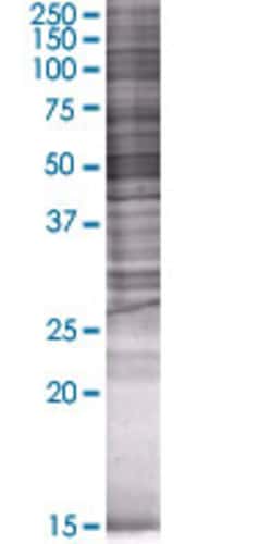 Abnova MLYCD 293T Cell Transient Overexpression Lysate (Denatured) 100 &mu;L | Buy Online | Abnova&trade; | Fisher Scientific