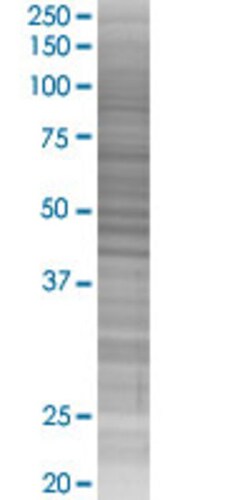 Abnova HEY1 293T Cell Transient Overexpression Lysate (Denatured) 100 &mu;L | Buy Online | Abnova&trade; | Fisher Scientific
