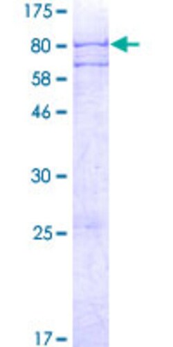 Abnova Human ADAT1 Full-length ORF (AAH02758.1, 1 a.a. - 502 a.a.) Recombinant Protein with GST-tag at N-terminal 2 &mu;g | Buy Online | Abnova&trade; | Fisher Scientific