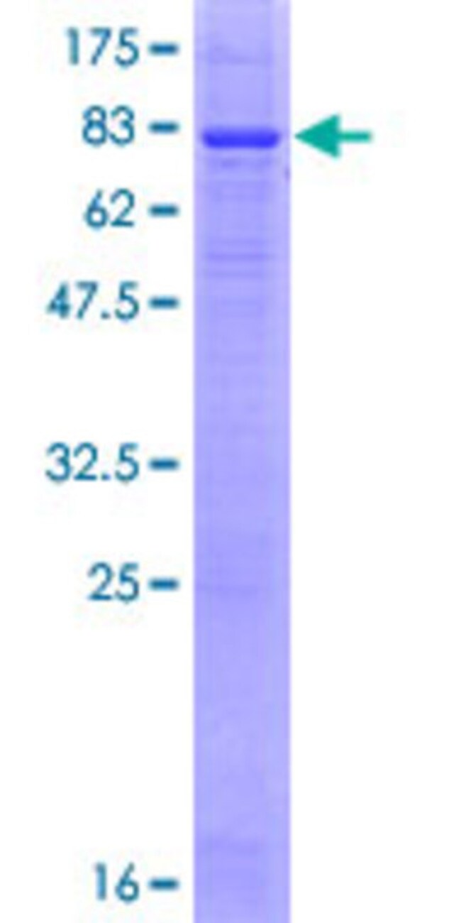 Abnova™ Human PLD3 Fulllength ORF (NP_001026866.1, 1 a.a. 490 a.a.) Protein with