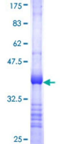 Abnova Human CBY1 Partial ORF (NP_056188, 18 a.a. - 126 a.a.) Recombinant Protein with GST-tag at N-terminal 10 &mu;g | Buy Online | Abnova&trade; | Fisher Scientific