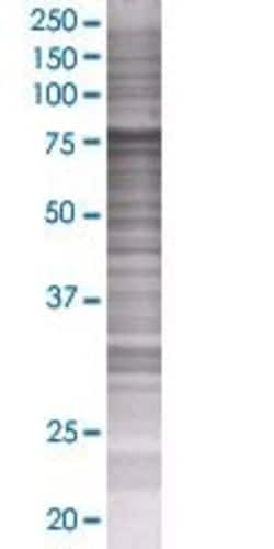 Abnova FBXO7 293T Cell Transient Overexpression Lysate (Denatured) 100 &mu;L | Buy Online | Abnova&trade; | Fisher Scientific