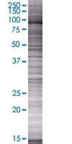 Abnova OSBPL3 293T Cell Transient Overexpression Lysate (Denatured) 100 &mu;L | Buy Online | Abnova&trade; | Fisher Scientific