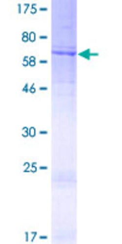 Abnova Human WDR21A Full-length ORF (NP_851937.1, 1 a.a. - 395 a.a.) Recombinant Protein with GST-tag at N-terminal 2 &mu;g | Buy Online | Abnova&trade; | Fisher Scientific