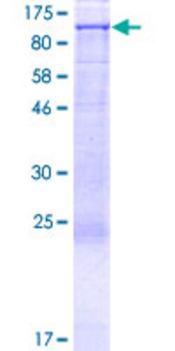 Abnova Human NOC2L Full-length ORF (AAH03555.1, 1 a.a. - 749 a.a.) Recombinant Protein with GST-tag at N-terminal 2 &mu;g | Buy Online | Abnova&trade; | Fisher Scientific