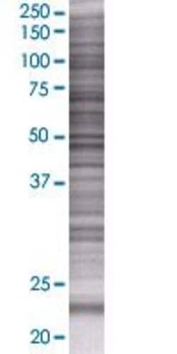 Abnova PLDN 293T Cell Transient Overexpression Lysate (Denatured) 100 &mu;L | Buy Online | Abnova&trade; | Fisher Scientific