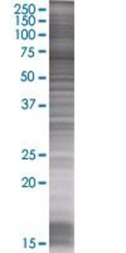 Abnova VPS33B 293T Cell Transient Overexpression Lysate (Denatured) 100 &mu;L | Buy Online | Abnova&trade; | Fisher Scientific