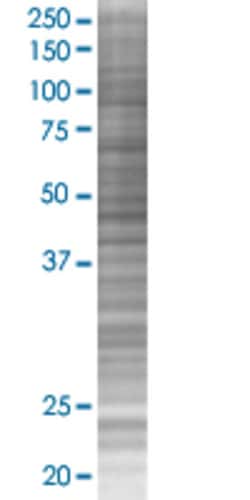 Abnova&trade;&nbsp;HSPB8 293T Cell Transient Overexpression Lysate (Denatured)