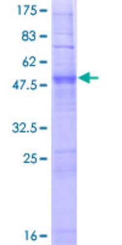 Abnova Human OR2J2 Full-length ORF (NP_112167.1, 1 a.a. - 312 a.a.) Recombinant Protein with GST-tag at N-terminal 10 &mu;g | Buy Online | Abnova&trade; | Fisher Scientific