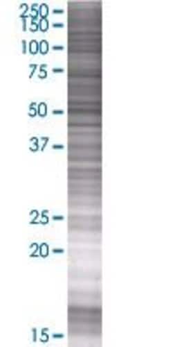 Abnova RANBP6 293T Cell Transient Overexpression Lysate (Denatured) 100 &mu;L | Buy Online | Abnova&trade; | Fisher Scientific