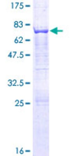 Abnova Human AP3M1 Full-length ORF (NP_036227.1, 1 a.a. - 418 a.a.) Recombinant Protein with GST-tag at N-terminal 25 &mu;g | Buy Online | Abnova&trade; | Fisher Scientific