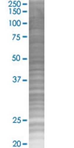 Abnova NAAA 293T Cell Transient Overexpression Lysate (Denatured) (T02) 100 &mu;l | Buy Online | Abnova&trade; | Fisher Scientific
