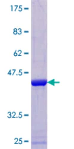 Abnova Human IL1F8 Full-length ORF (NP_775270.1, 1 a.a. - 157 a.a.) Recombinant Protein with GST-tag at N-terminal 25 &mu;g | Buy Online | Abnova&trade; | Fisher Scientific