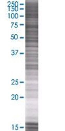 Abnova CSDC2 293T Cell Transient Overexpression Lysate (Denatured) 100 &mu;L | Buy Online | Abnova&trade; | Fisher Scientific