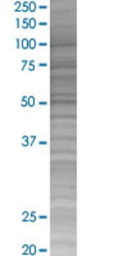 Abnova&trade;&nbsp;ICOS 293T Cell Transient Overexpression Lysate (Denatured)