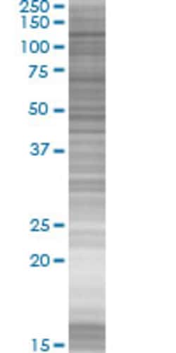 Abnova PDZRN4 293T Cell Transient Overexpression Lysate (Denatured) (T03) 100 &mu;L | Buy Online | Abnova&trade; | Fisher Scientific