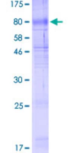 Abnova Human SLC40A1 Full-length ORF (NP_055400.1, 1 a.a. - 571 a.a.) Recombinant Protein with GST-tag at N-terminal 2 &mu;g | Buy Online | Abnova&trade; | Fisher Scientific