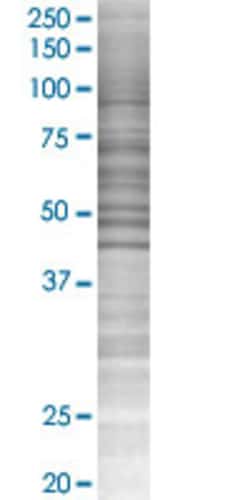 Abnova&trade;&nbsp;SLC40A1 293T Cell Transient Overexpression Lysate (Denatured)