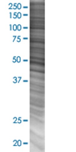 Abnova HDGFRP3 293T Cell Transient Overexpression Lysate (Denatured) 100 &mu;L | Buy Online | Abnova&trade; | Fisher Scientific