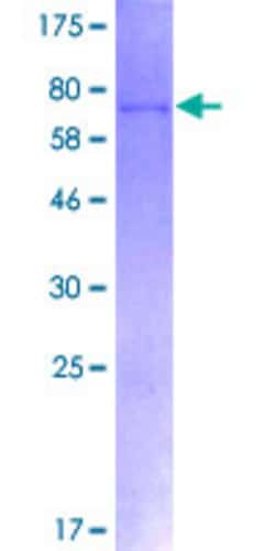 Abnova Human FOXP3 Full-length ORF (NP_054728.2, 1 a.a. - 431 a.a.) Recombinant Protein with GST-tag at N-terminal 2 &mu;g | Buy Online | Abnova&trade; | Fisher Scientific