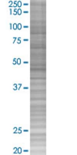 Abnova EXOSC3 293T Cell Transient Overexpression Lysate (Denatured) (T02) 100 &mu;L | Buy Online | Abnova&trade; | Fisher Scientific
