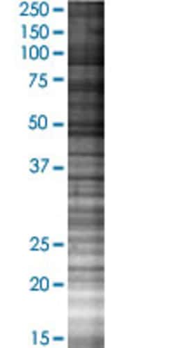 Abnova&trade;&nbsp;ZBTB7B 293T Cell Transient Overexpression Lysate (Denatured) (T02)