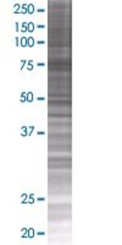Abnova THAP4 293T Cell Transient Overexpression Lysate (Denatured) (T01) 100 &mu;L | Buy Online | Abnova&trade; | Fisher Scientific