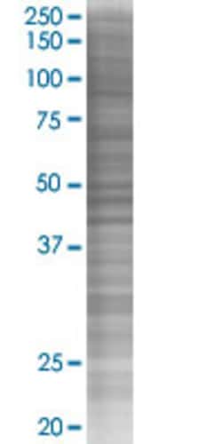 Abnova TNNI3K 293T Cell Transient Overexpression Lysate (Denatured) 100 &mu;L | Buy Online | Abnova&trade; | Fisher Scientific