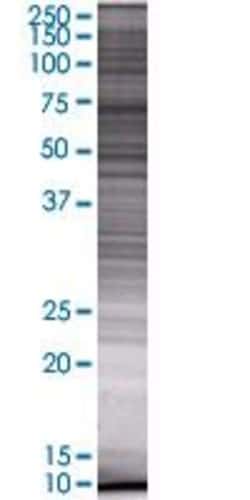 Abnova MRPS2 293T Cell Transient Overexpression Lysate (Denatured) 100 &mu;L | Buy Online | Abnova&trade; | Fisher Scientific