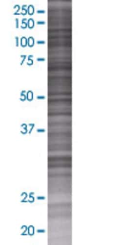 Abnova™ CRBN 293T Cell Transient Overexpression Lysate (Denatured)
