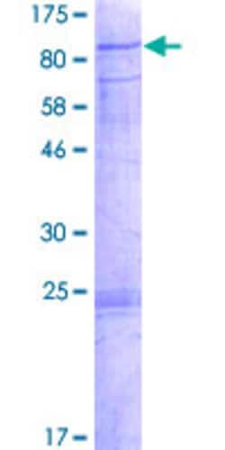 Abnova Human CDKL3 Full-length ORF (AAH41799.1, 1 a.a. - 592 a.a.) Recombinant Protein with GST-tag at N-terminal 2 &mu;g | Buy Online | Abnova&trade; | Fisher Scientific