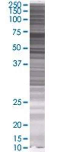 Abnova TXNDC3 293T Cell Transient Overexpression Lysate (Denatured) 100 &mu;L | Buy Online | Abnova&trade; | Fisher Scientific