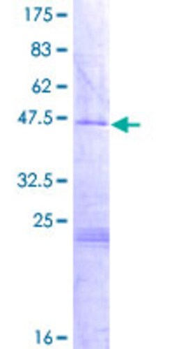 Abnova Human MRPL35 Full-length ORF (NP_057706.2, 1 a.a. - 188 a.a.) Recombinant Protein with GST-tag at N-terminal 2 &mu;g | Buy Online | Abnova&trade; | Fisher Scientific