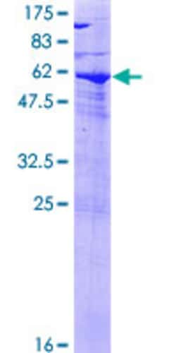 Abnova Human SPG21 Full-length ORF (NP_057714.1, 1 a.a. - 308 a.a.) Recombinant Protein with GST-tag at N-terminal 25 &mu;g | Buy Online | Abnova&trade; | Fisher Scientific