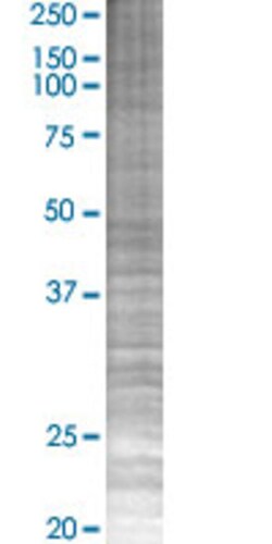 Abnova CRLF3 293T Cell Transient Overexpression Lysate (Denatured) (T02) 100 &mu;L | Buy Online | Abnova&trade; | Fisher Scientific