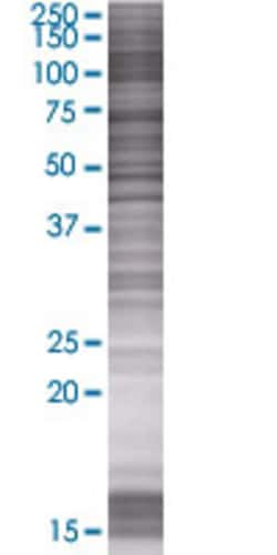 Abnova C14orf129 293T Cell Transient Overexpression Lysate (Denatured) 100 &mu;L | Buy Online | Abnova&trade; | Fisher Scientific