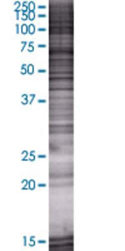 Abnova ZNF581 293T Cell Transient Overexpression Lysate (Denatured) 100 &mu;l | Buy Online | Abnova&trade; | Fisher Scientific