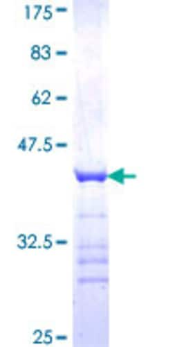 Abnova&trade;&nbsp;Human ARMCX3 Partial ORF (NP_057691, 278 a.a. - 379 a.a.) Recombinant Protein with GST-tag at N-terminal:  